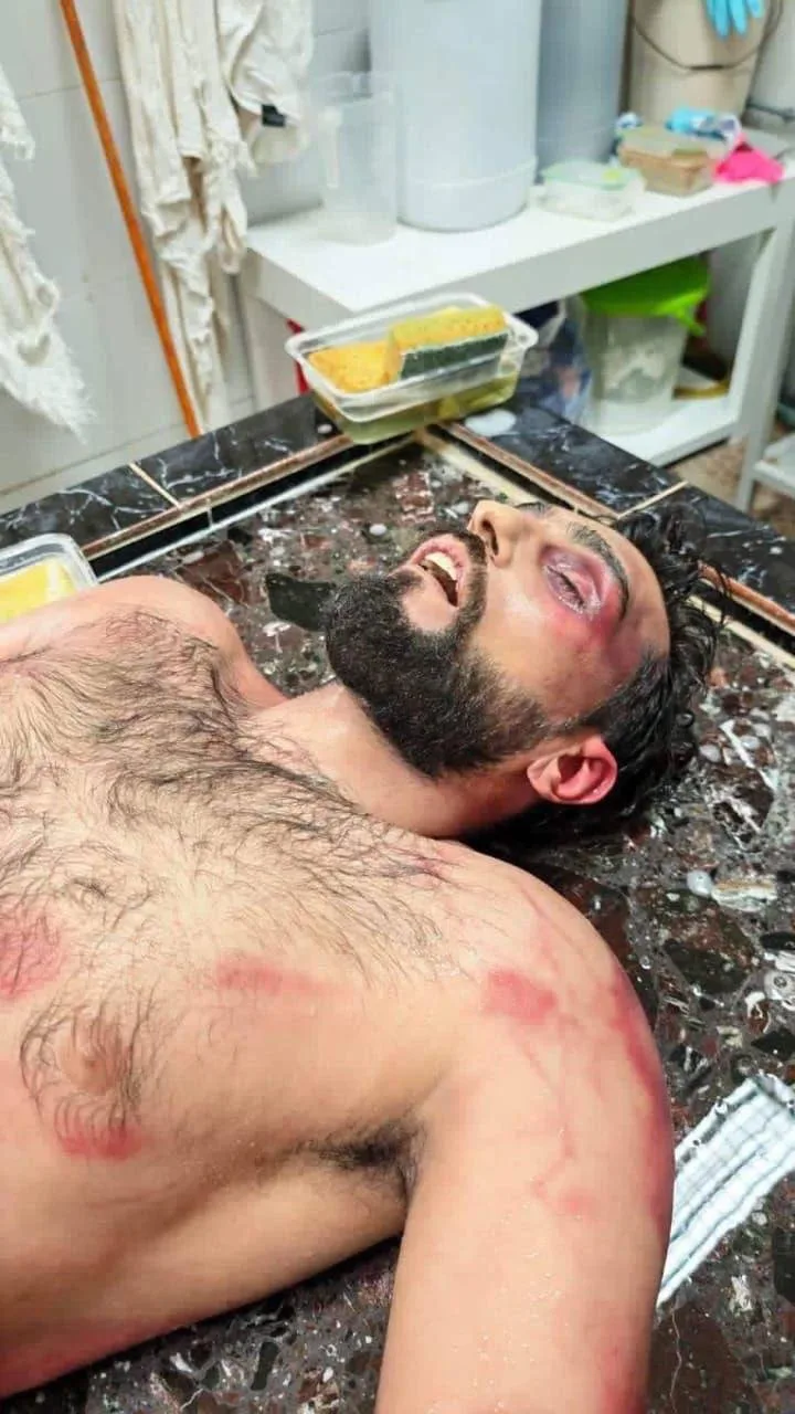 تصاعد الانتقادات الحقوقية في البحرين بعد وفاة الشاب محمد الموسوي
